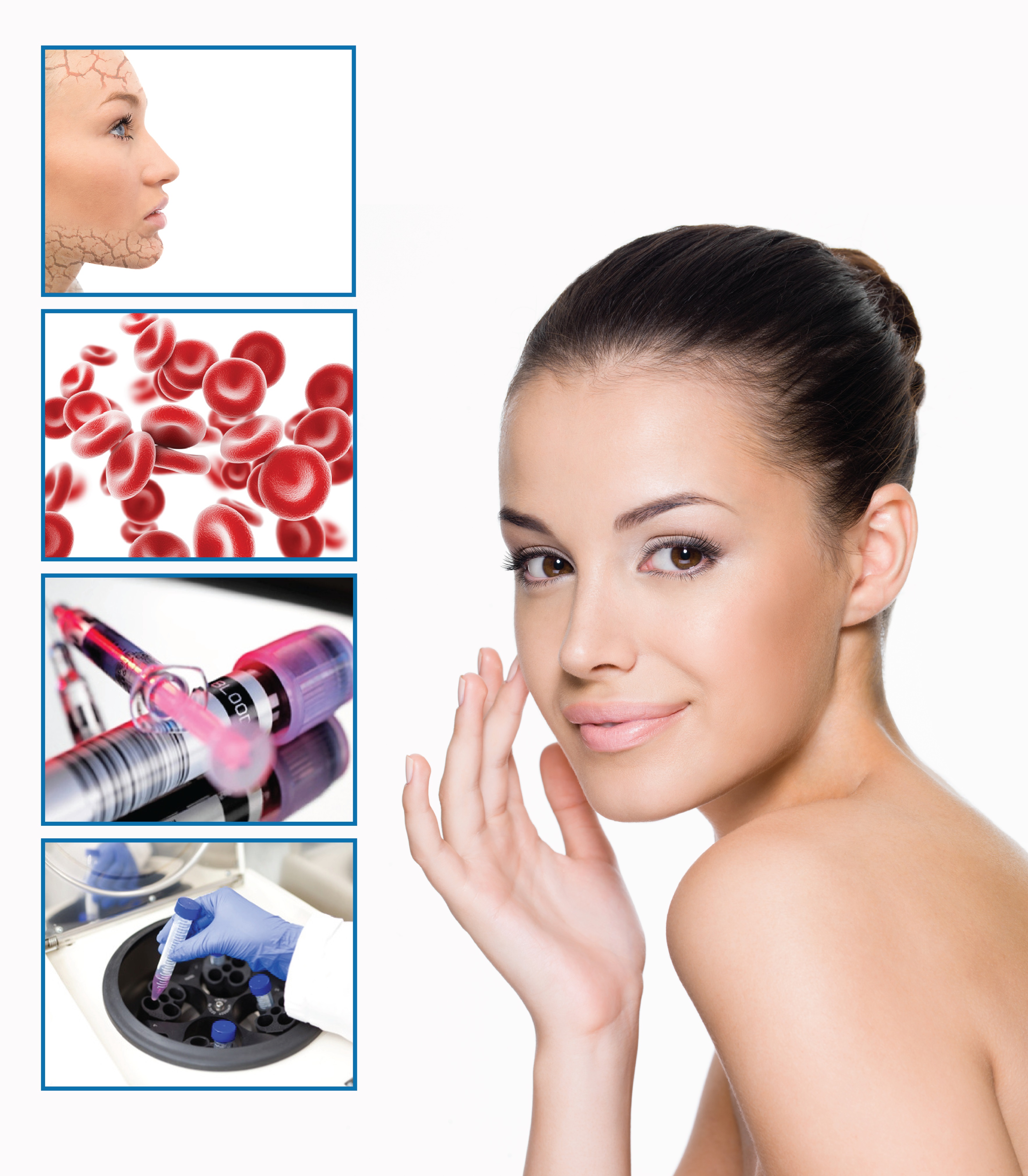 Плазмолифтинг